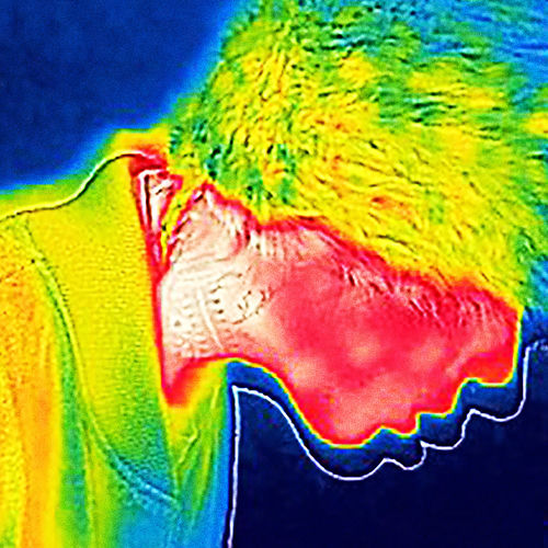 Kid milli – BORA – Single